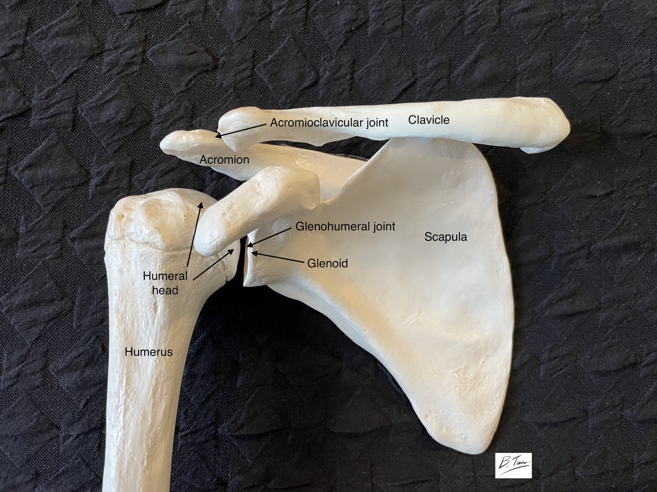 Normal Bony Shoulder Anatomy