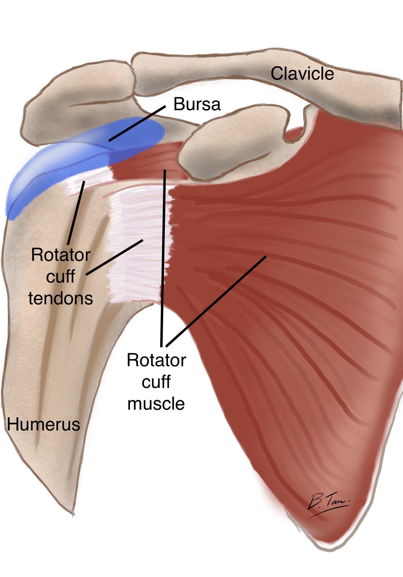 Normal Subacromial Bursa