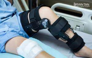 The Ultimate Guide to ACL Ligament Tears and Their Treatment - Dr Bryan Tan